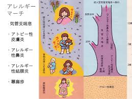 アレルギー⑧